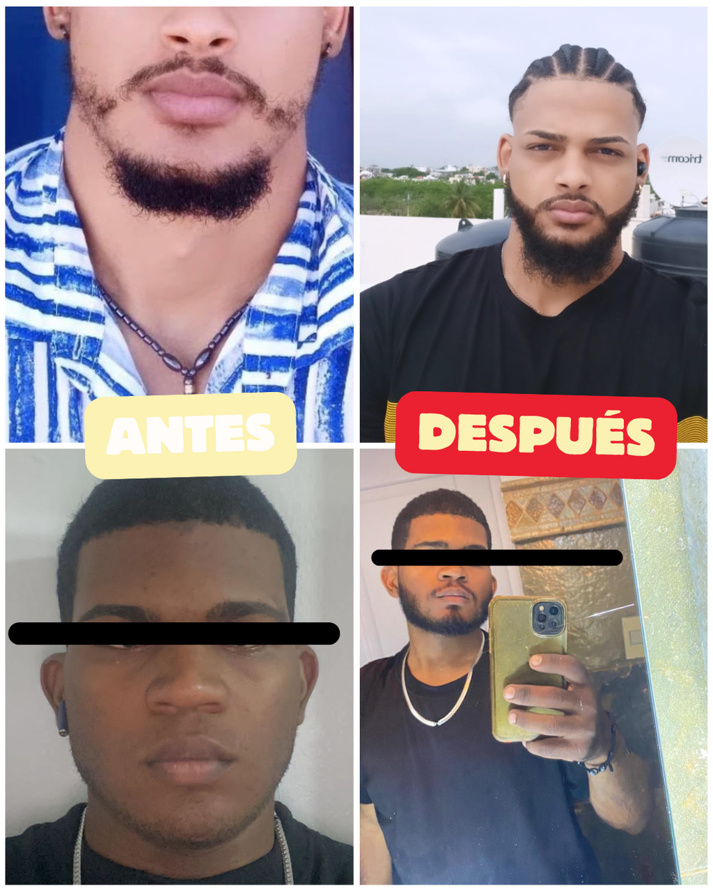 Before and after comparison of The Great Odin Viking Growth Treatment results.